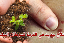 علاج جديد في التّربة يكافح سرطان الجلد