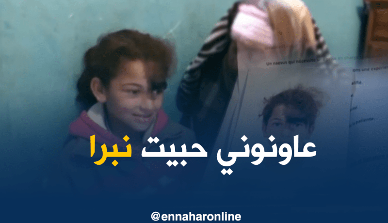 ليلى تناشد القلوب الرحيمة لمعالجة تشوهها الخلقي