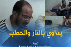 بالفيديو..القصب والنار لعلاج مرض التهاب الكبد الفيروسي بالبيض