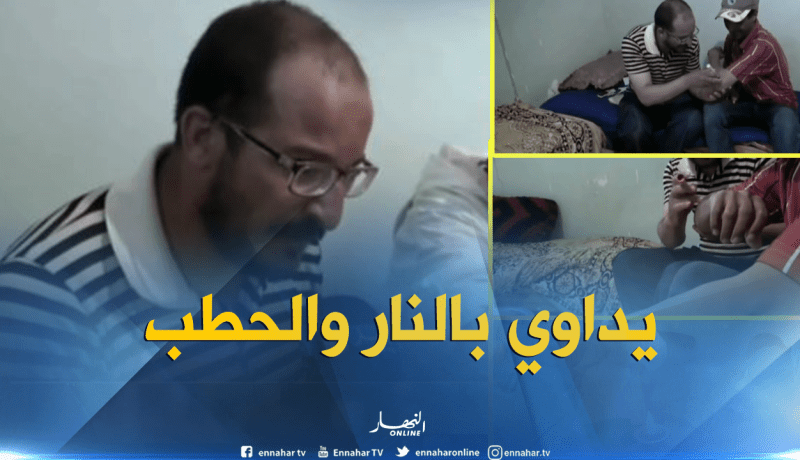 بالفيديو..القصب والنار لعلاج مرض التهاب الكبد الفيروسي بالبيض