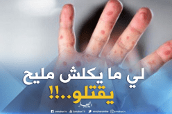 وزارة: “البوحمرون” يقتل الأشخاص الذين يعانون من سوء التغذية