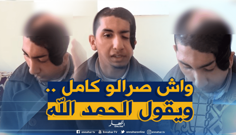 شاهد..بعد أن بترت يده وكسرت جمجمته بسبب حادث ..محمد يحمد الله