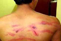 اعتقال كولونيل نيبالي في بريطانيا بتهمة ممارسة التعذيب في بلاده
