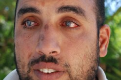 “منير” ينتظر التفاتة جادة من عمار تو لاسترجاع بصره