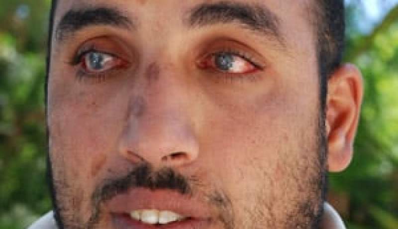 “منير” ينتظر التفاتة جادة من عمار تو لاسترجاع بصره