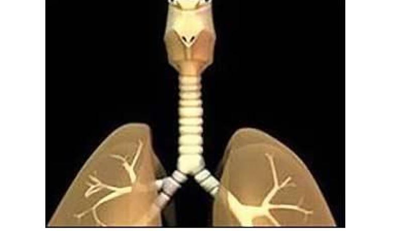 إيران تنجح في أول عملية زرع قصبة هوائية اصطناعية في العالم