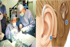 الجزائر تجري أول جراحة لزراعة قوقعة أذن إلكترونية بإفريقيا