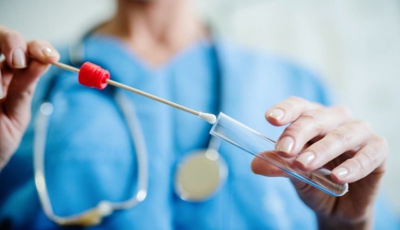 تخفيض سعر تحاليل PCR في عدد من المخابر الخاصة