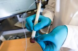 اختراع قلم يكشف السرطان في 10 ثوان