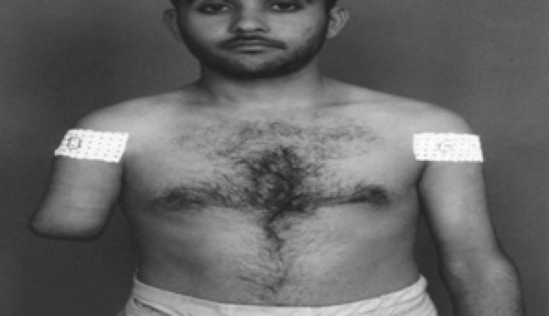 حادث عمل خطير يقلب حياته واهتماماته المستقبلية:عاصم رأى الطاحونة تبتلع ذراعه وتطحنها طحنا، وهو اليوم يستنجد بولد عباس والطيب لوح