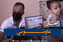 حالته تُبكي الحجر.. الرضيع “أنس” يعاني من مرض نادر ينخر جسده