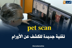 تيزي وزو: pet scan..للكشف الدقيق عن الأورام الخبيثة..الأول وطنيا والرابع إفريقيا
