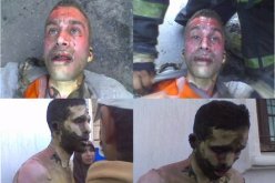 وفاة احد  العاطلين عن العمل بعد إحراق نفسه  في المغرب