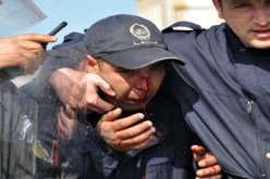 إصابة 260 مناصر من بينهم 136 شرطي بملاعب وسط البلاد
