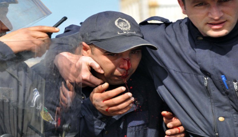 إصابة 260 مناصر من بينهم 136 شرطي بملاعب وسط البلاد