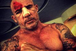 بطل Prison Break يتعرض لحادث في المغرب ويصاب بعدة كسور