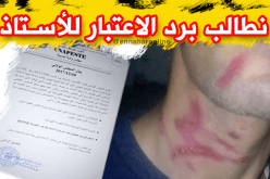 بالصور.. مدير ثانوية يعتدي على أستاذ بالمسيلة والكنابست يستنكر