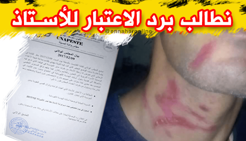 بالصور.. مدير ثانوية يعتدي على أستاذ بالمسيلة والكنابست يستنكر