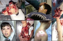 250 جريح في حرب المفرقعات ليلة المولد النبوي