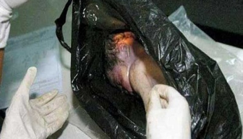 العثور على جثة جنين داخل حقيبة في مستغانم