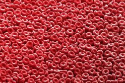 فحص خلايا الدم يسهم في الكشف المبكر عن السرطان