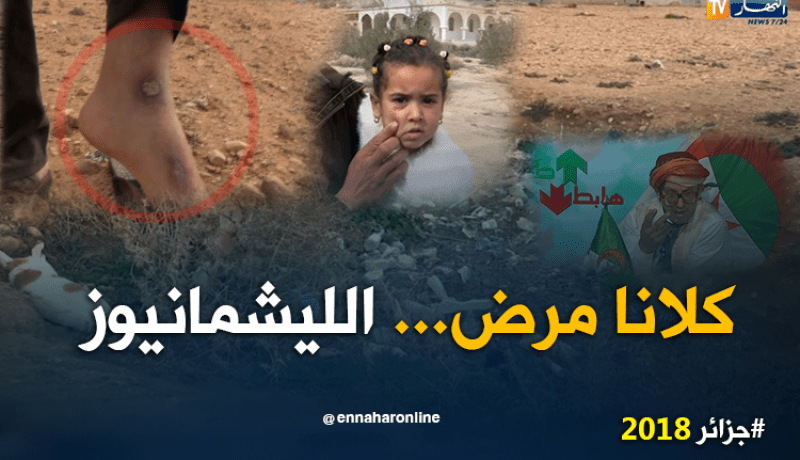 مرض الليشمانيوز ينتشر ببلدية القصبات بسبب الصرف الصحي