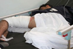 شاب يضرم النار في جسديه أمام مقر الأمن الحضري في مستغانم