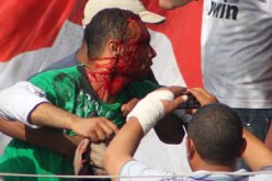 وزارة الدفاع ترفض زيارة وفد البرلمان لمصابى العباسية في مصر
