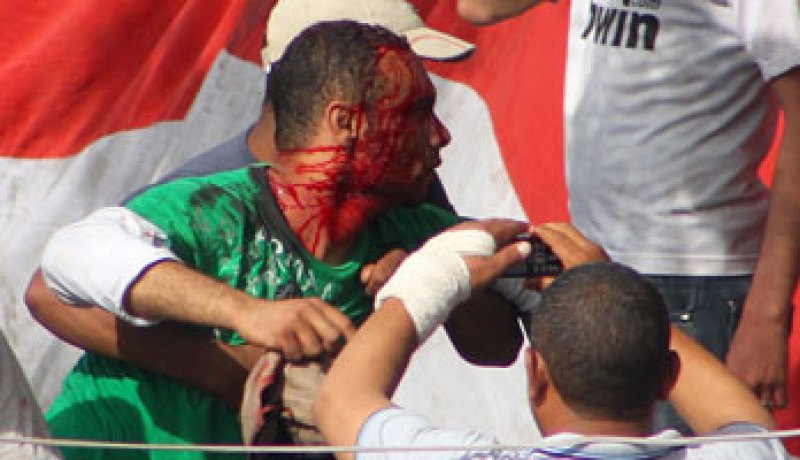 وزارة الدفاع ترفض زيارة وفد البرلمان لمصابى العباسية في مصر