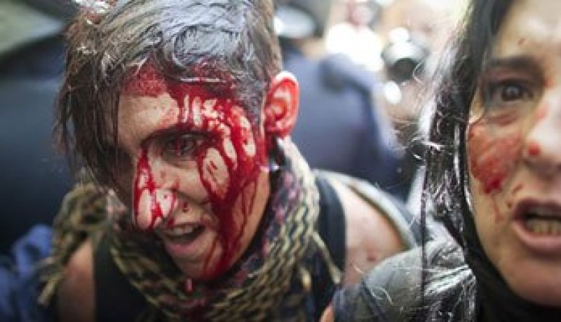 ء70 مصابا حصيلة احتجاجات إسبانية ضد إجراءات التقشف