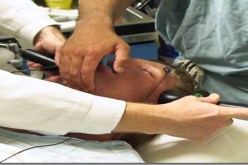 الصدمات الكهربائية المحدودة للمخ تقوي الذاكرة