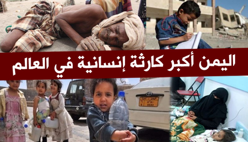 فيديو.. اليمن أكبر كارثة إنسانية في العالم