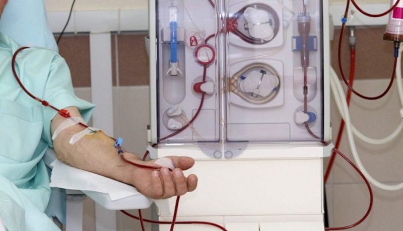 4000 حالة جديدة للقصور الكلوي سنويا بالجزائر