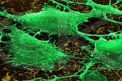 الصيام قد يساعد على مكافحة السرطان ويعزز فعالية العلاج الكيميائي