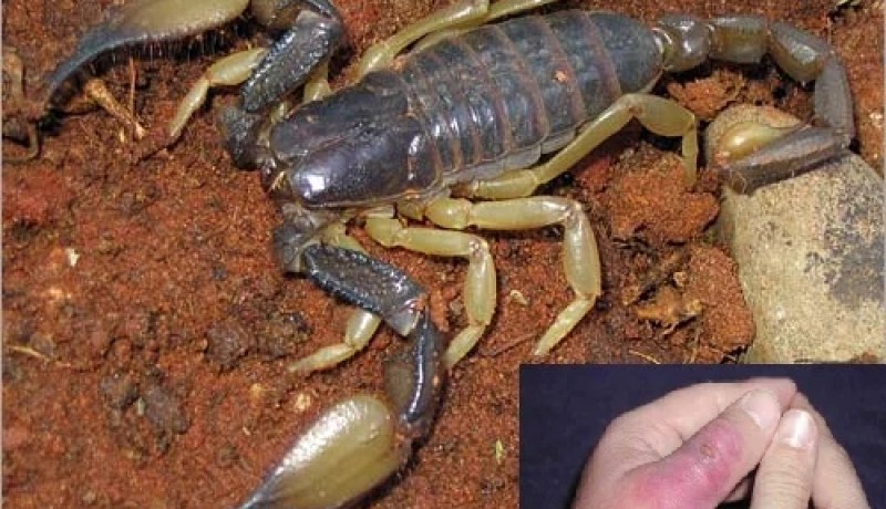 تسجيل حالة وفاة واحدة و 954 مصاب بالتسمم العقربي خلال السداسي الاول