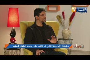 التخلص من الوحمة..هذه هي الطرق