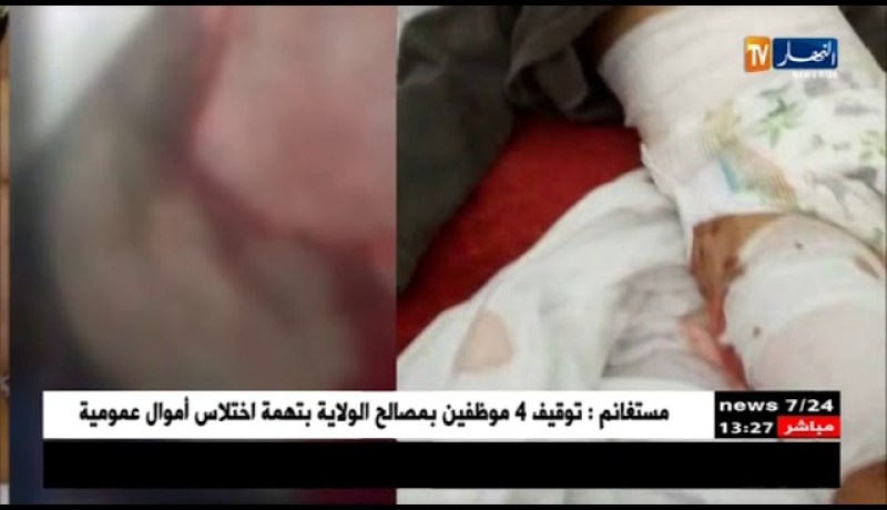 غرداية: مشاهد صادمة لمخلفات هجوم قطيع من الكلاب المسعورة على طفل وعجوز