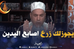 الشيخ شمس الدين : زرع أصابع اليدين ليس من تغيير خلق الله !
