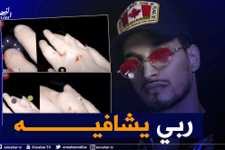 سولكينغ يتعرض لحادث بدراجة نارية ويضع الجبس