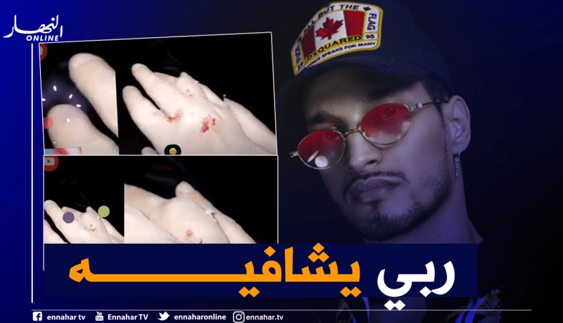 سولكينغ يتعرض لحادث بدراجة نارية ويضع الجبس