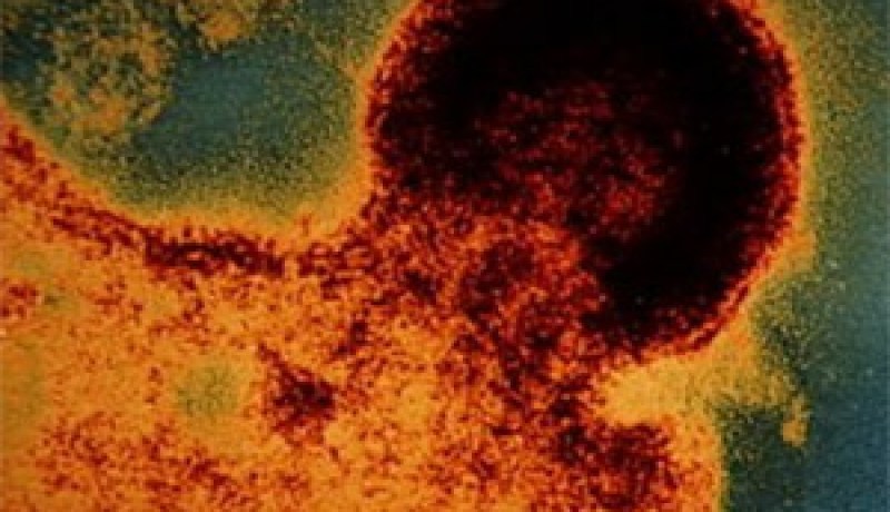 60 مركزا للكشف المسبق قريبا و 3790 حامل لفيروس “السيدا” بالجزائر