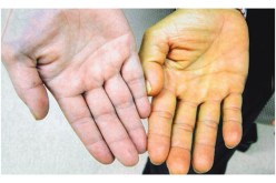 لو كان بوسعي تغيير لون بشرتي لأجلها لفعلت