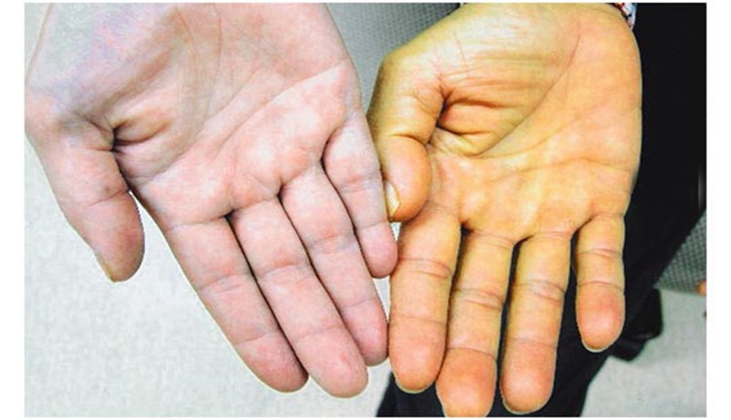 لو كان بوسعي تغيير لون بشرتي لأجلها لفعلت