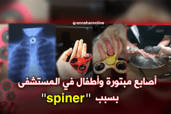 اللغز الذي يشكل خطرا على الأطفال ..Hand spinner