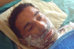 “النهار” تنقل قصة الرجل الذي أضرم النار في جسمه بقالمة