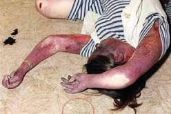 تلجأ إلى تناول المبيدات الحشرية وسموم الفئران ومهدئات:مائة حالة انتحار كل صيف بوهران، 61 بالمائة من ضحاياها فتيات