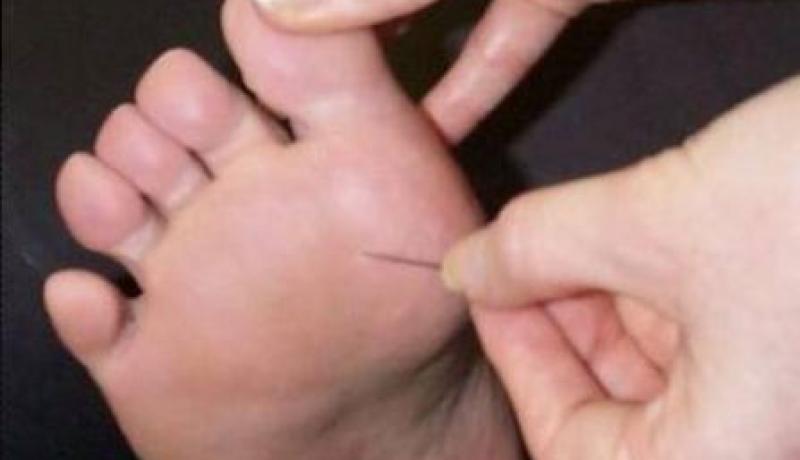المستشفيات تطرد مرضى رِجل السكري وترفض التكفل بهم