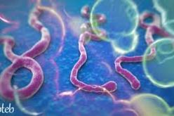 الحماية المدنية بصدد وضع ترتيب للتكفل بحالات محتملة لإيبولا