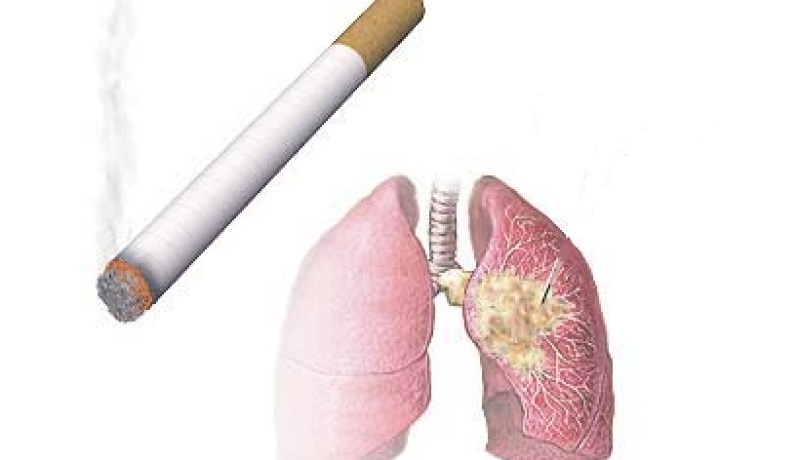 حملة تحسيسية حول أضرار التدخين الخميس القادم بتلمسان