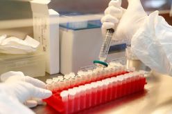 دراسة مُدهشة.. أشخاص يمتلكون مناعة ضد كورونا رغم عدم إصابتهم بها!